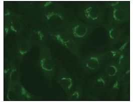 Anti-TGN38 antibody produced in rabbit~1 mg/mL, affinity isolated antibody, buffered aqueous solution