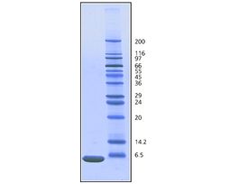 Ubiquitin from bovine erythrocytesBioUltra, >=98% (SDS-PAGE), essentially salt-free, lyophilized powder 5MG