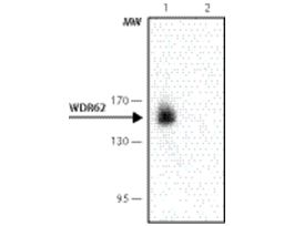 Monoclonal Anti-WDR62 antibody produced in mouse~1.0 mg/mL, clone 3G8, purified immunoglobulin, buffered aqueous solution