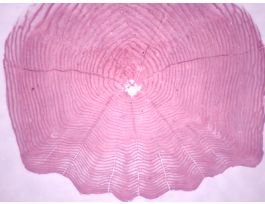CYCLOID SCALE (WM) SLIDE STAINED