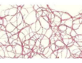 FAT BODIES (SM) SB SLIDE