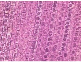 FISH & ONION MITOSIS (SECT)IH