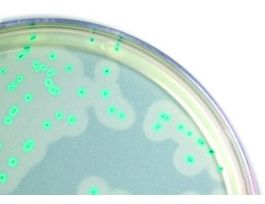 MEDIUM LISTERIA CHRMG PLATED 19ML PK10