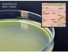 MEDIUM BHI AGAR 25X100MM PLATE 60ML PK5