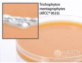 MEDIUM V9 AGAR 15X100MM PLATE MYCOLOGY