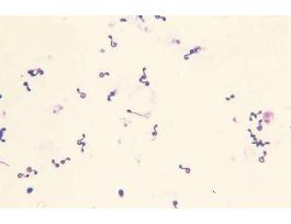 HYDRA NEMATOCYSTS (WM) STAINED SMEAR