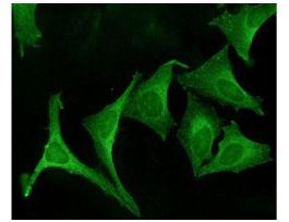 CALNEXIN-CT ANTIBODY 200UL