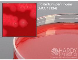 SCHAEDLER AGAR W/SB H/K PK10