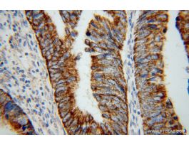 ANTI-TST(POLYCLONAL)