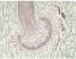 ANTHOCEROS SPOROPHYTE (LS)QS
