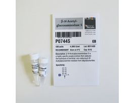 BETA-N-ACETYLGLUCOSAMINIDASE S P0744S