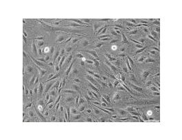 H-CORD BLOOD ENDOTHELIAL PROGENITOR CELL