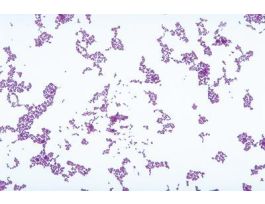 FD LACTOCOCCUS LACTIS (G+ COCCI)