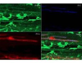 BETA ACTIN ANTIBODY 25UL
