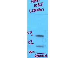 AQUAPORIN 1 ANTIBODY 100UL