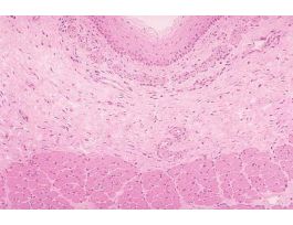 ESOPHAGUS (CS) 1.5UM H&E SLIDE (MAMMAL)