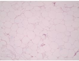ADIPOSE TISSUE (SECT)H&E SLIDE (HUMAN)