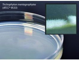 MEDIUM POTATO DEXTROSE AGAR PLATED PK10