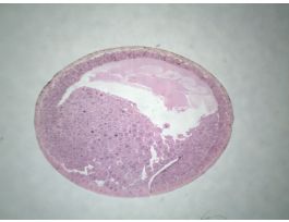 FROG-CRESCENT BLASTOPORE TYP. SAG.H&E