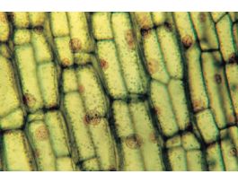 CHLOROPLASTS (WM) AF&FG LGE LEAF CELLS.