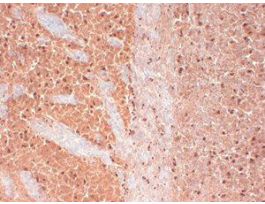 CAV3-2 ANTIBODY 100UG