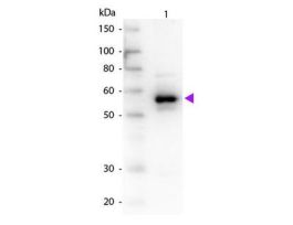 A-1-TRYPSIN ANTIBODY 25UL