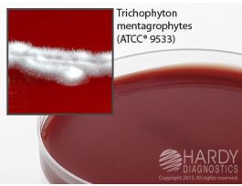 LIVER INFUSION AGAR SELECTIVE PLATE PK10