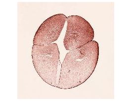 FROG-EARLY CLEAVAGE TYP. SAG. SEC. H&E