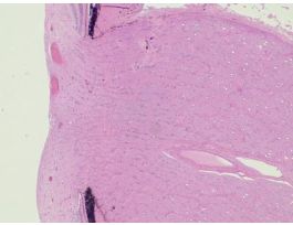 EYE-OPTICNERVEEXTRANCE (MLS)H&E(PRIMATE)