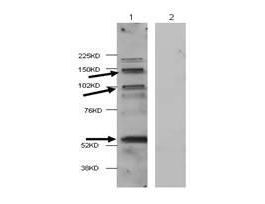HDAC4 ANTIBODY 100 UG