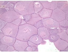 FROG-OVARY (SECT) H&E OOGENESIS.