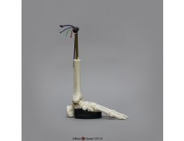 ANKLE SPRAIN MODEL