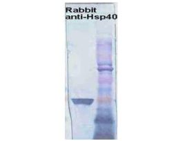 HSP40 ANTIBODY 100UL