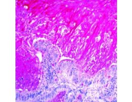 MUCICARMINE KIT 100RXN