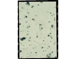 CHILOMASTIX MESNILI-TROPHO-ZOITES(WM)IH