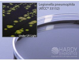 AGAR BCYE SLCTV W/CAV ATB 15X100MM PLATE