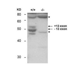 BIN1 ANTIBODY 25UL