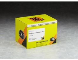 VIRAL ACID EXTRACTON KIT