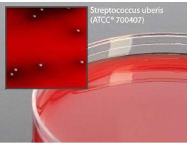 PLT TSA W BLD ESCULIN PK100