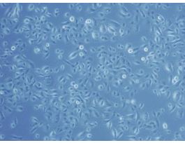 HNEpC-c: Human Nasal Epithelial Cells (HNEpC)