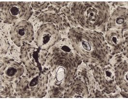 BONE-GROUND PREP (CS&LS) (HUMAN) THIN