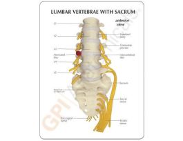MODEL FLEX LUMBAR VERTEBRAE W/ NERVES