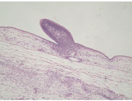 BIRD SKIN H&E DEVELOPING FEATHERS