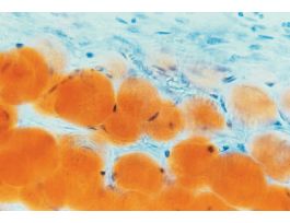 ADIPOSE TISSUE (WM) SR&H M MESENTARY