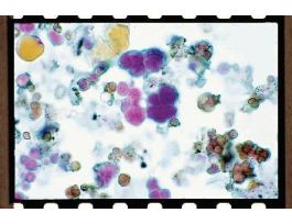 PLEUROCOCCUS (PROTOCOCCUS) WM