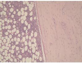 FEMUR (LS) H&E M DECALCIFIED&STAIN
