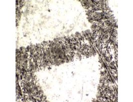 Prepared Slide, Letter 'E'