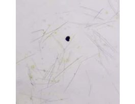 Prepared Slide, Grantia Spicules, Wm