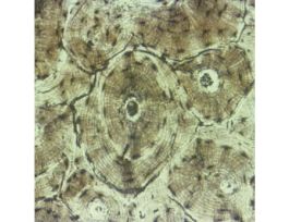 Prepared Slide, Human Bone Ground, Cs