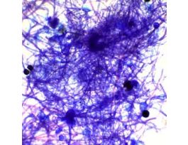 Prepared Slide, Bread Mold, Sexual